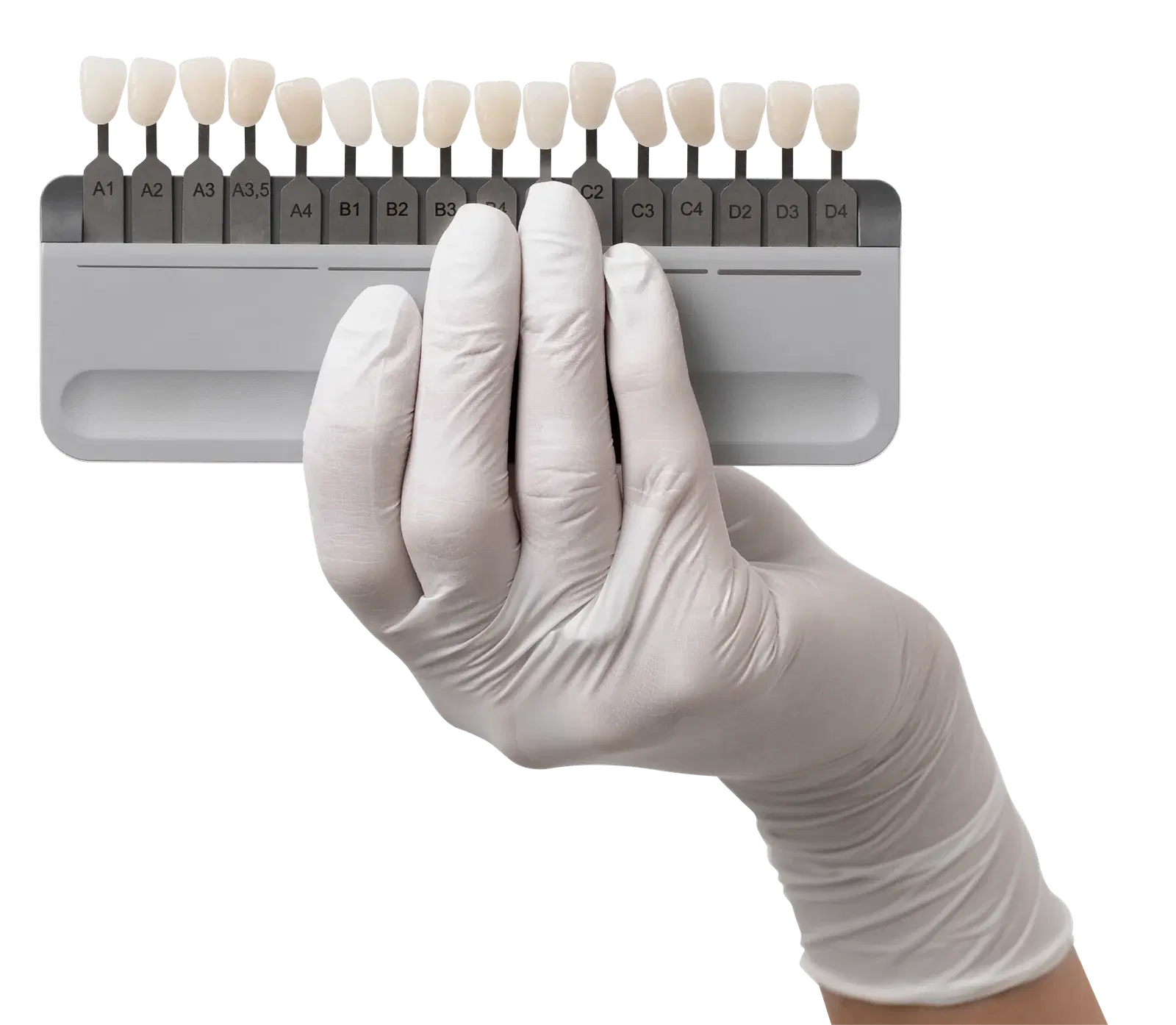 Diseño de sonrisa con carillas dentales