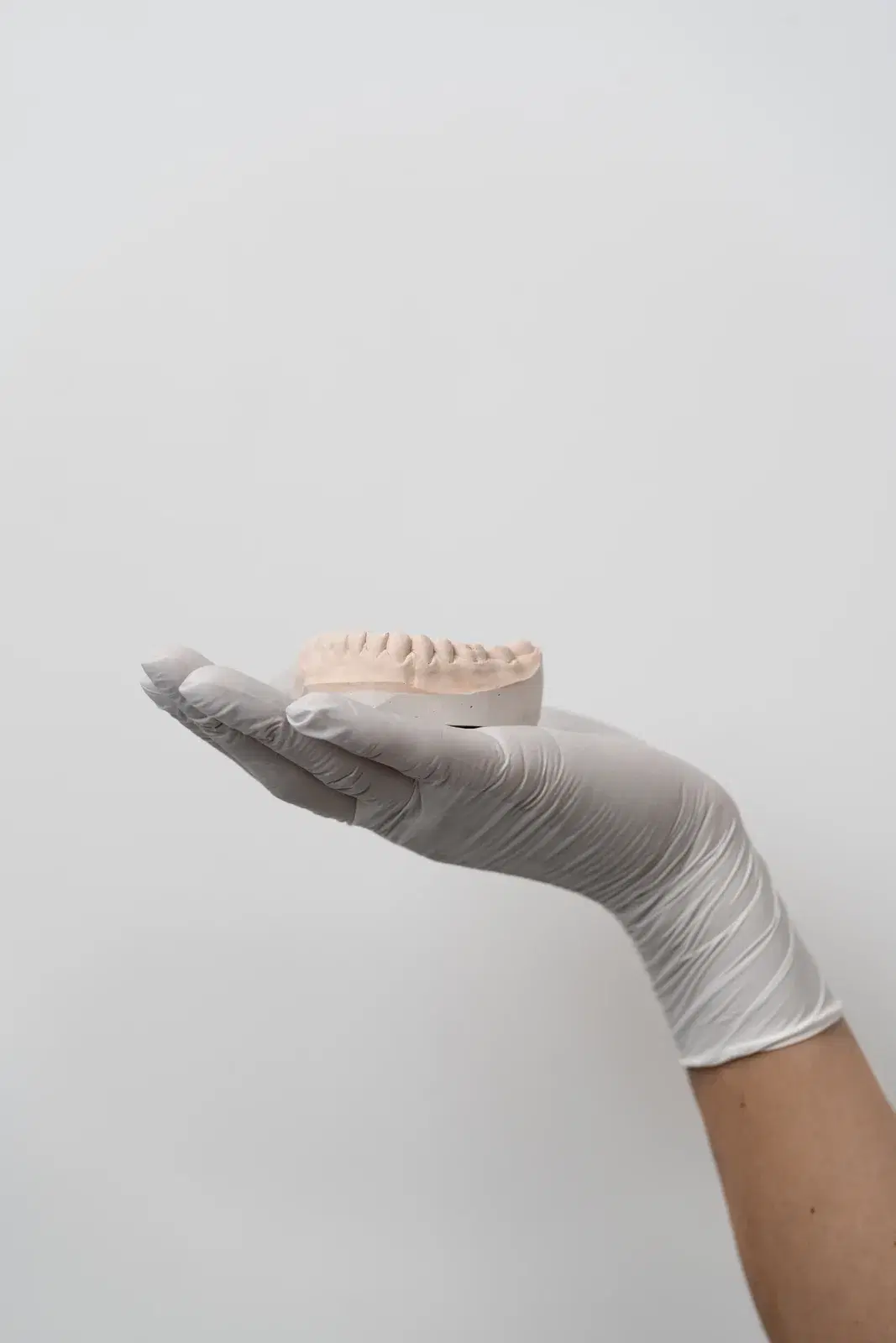 Implantología dental con prótesis